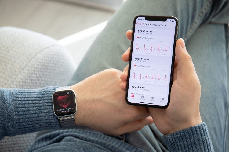 Mittlerweile lässt sich ein EKG häufig direkt mit der Smartwatch durchführen