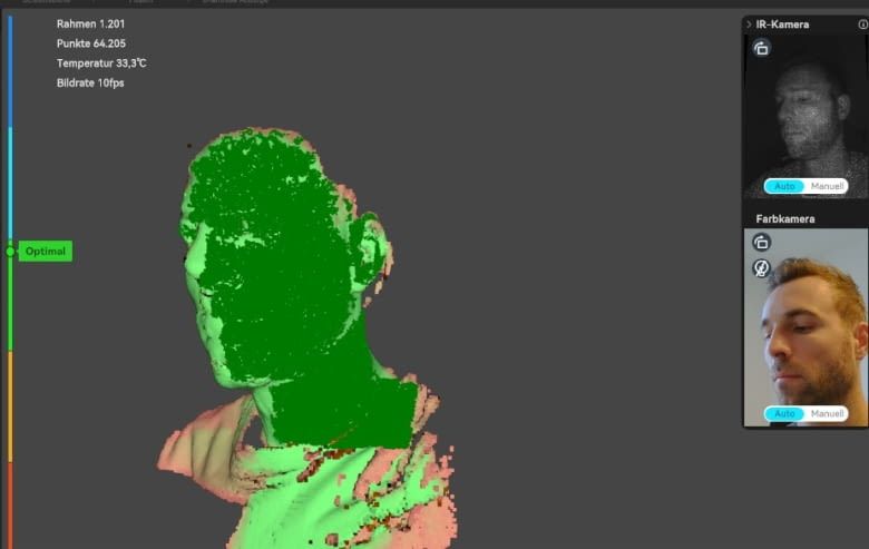 Ergebnis S1 Gesichtsscan