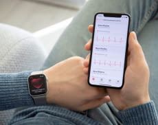Ora è spesso possibile eseguire un ECG direttamente con lo smartwatch
