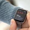 Smartwatches erhalten immer mehr Gesundheitsfeatures