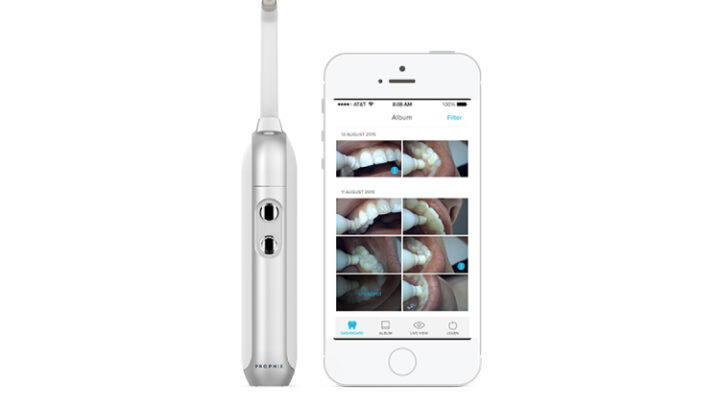 Prophix by onvi | Die smarte Zahnbürste mit Videofunktion