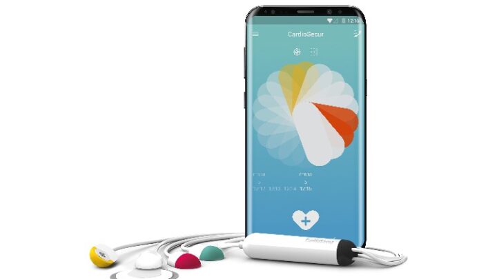 CardioSecur – Diagnose des Herzzustands per Smartphone