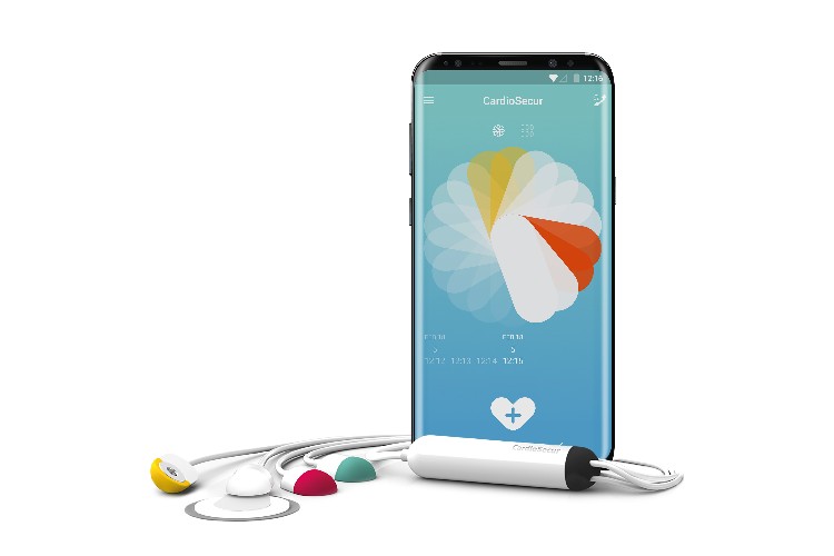 CardioSecur – Diagnose des Herzzustands per Smartphone