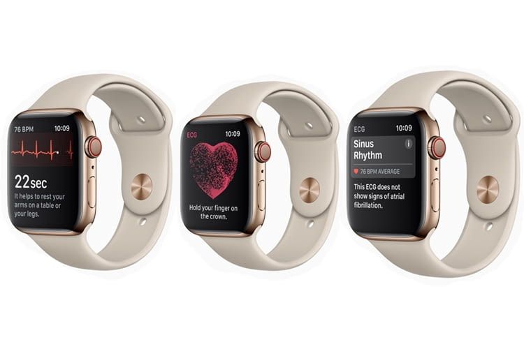 Mit Apple Watch 4 EKG am Handgelenk messen und erfahren, ob die Herzrhythmus-Werte ok sind Mit Apple Watch 4 EKG am Handgelenk messen und erfahren, ob die Herzrhythmus-Werte ok sind
