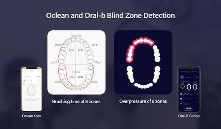 oclean-blindzonen-ergennung oclean-blindzonen-ergennung