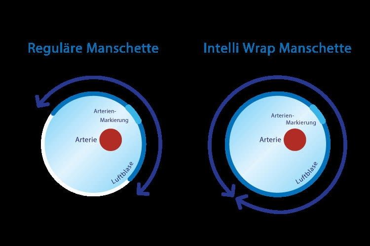 Das Prinzip hiter der Intelli Wrap Manschette im Vergleich zu traditionellen Manschetten Das Prinzip hiter der Intelli Wrap Manschette im Vergleich zu traditionellen Manschetten