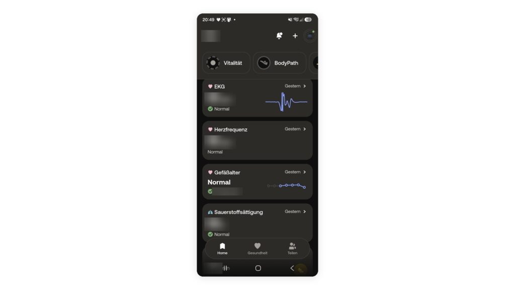Withings BodyScan 2 EKG Messung in der App